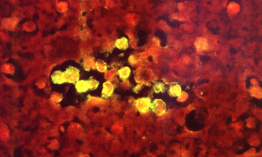 Brain-eating amoeba kills child in Nebraska
