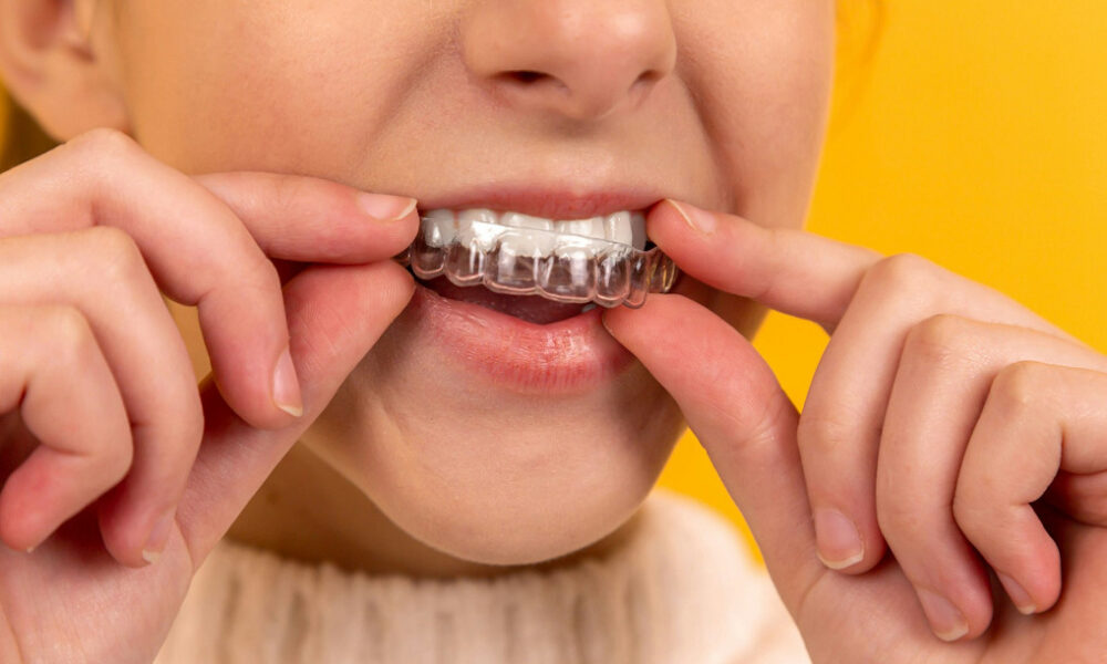 How Do Adults Choose Between Braces and Invisalign?